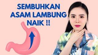 8 Cara Menyembuhkan Asam Lambung Naik ke Tenggorokan (PENGALAMAN PRIBADI)