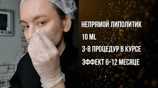 Липолитик по лицу  Убираем брыли и второй подбородок. Косметолог Елена Шультц