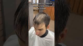 Мужская стрижка с залысинами на голове ️