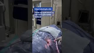 Грижани Эндоскоп билан олиш амалиёти! 93-401-10-50    #doctor #endoscopia #spine