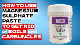 How to Get Rid of Boils and Carbuncles with Magnesium Sulphate Paste