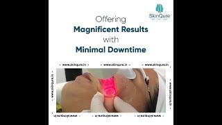 Scar removal Laser | Laser for scars | ResurFX Laser for scar | Laser Clinic in Delhi @skinqure