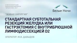 Мастер класс "Живая хирургия":  субтотальная резекция желудка или с внутрибрюшной лимфодиссекцией D2