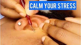 1 HOUR ASMR STRESS RELIEF SKIN INSPECTION WITH BUBBLEGUM || SLEEP THERAPY