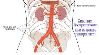 Симптом Воскресенкого при остром панкреатите #симптом #острый #панкреатит #пульс #аорта