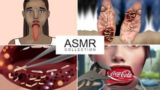 Combine ASMR Treatment Animation Compilation | ASMR Care Treatment 2D Animation | JINJJA 진짜 ASMR