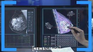 AI helps radiologists detect breast cancer: study | NewsNation Prime