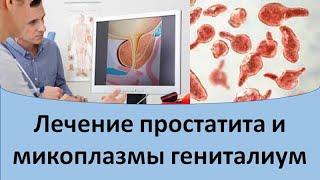 Лечение простатита и микоплазмы гениталиум