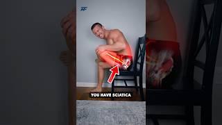 STOP Stretching Sciatica!