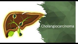 Cholangiocarcinoma