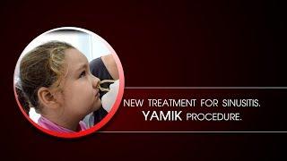 New Treatment for sinusitis. Yamik procedure - topical treatment of sinusitis.