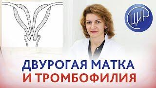 Двурогая матка и тромбофилия. Как сохранить беременность. Гемостаз, аспирин и клексан.