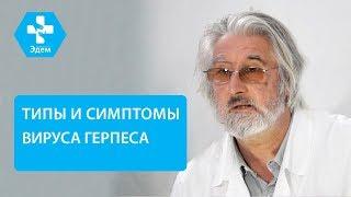  Типы вируса герпеса и особенности лечения каждого. Герпес на теле. ЭДЕМ. 12+