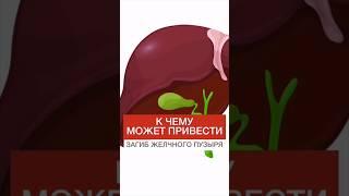 К ЧЕМУ МОЖЕТ ПРИВЕСТИ ЗАГИБ ЖЕЛЧНОГО ПУЗЫРЯ? #shorts #здоровье #нутрициолог #желчныйпузырь #желчный