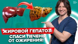 Опасность ЖИРНОЙ ПЕЧЕНИ! Как лечить ЖИРОВОЙ ГЕПАТОЗ? Симптомы, диагностика и ДИЕТА для печени