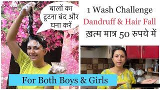 1 Wash Challenge | Get Rid of Dandruff And Hair Fall Permanently |  Dr. Upasana Vohra