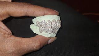 Let them permanent 18k gold with vvs  diamonds dry goldgrillz goldteeth grillz GoldKilos