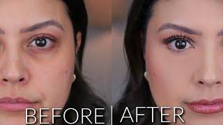 How To Achieve Flawless Skin and A Bright Under Eye | For Dark Circles