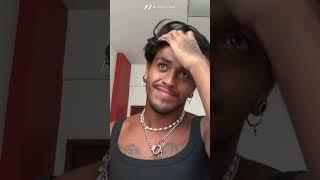 How to Get a Natural Hairline? | NEWTIMES HAIR | Hairline