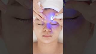 Blackheads, Whiteheads & Buildup? See What Hydro Dermabrasion Really Does! | Model: SR-AF1323