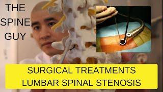 Part 3 - Surgical Treatments for Lumbar Spinal Stenosis