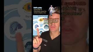 Ramsay Hunt syndrome vs Bell’s Palsy - What’s the Difference??