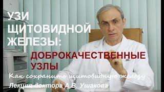 УЗИ Щитовидной железы: Доброкачественные узлы щитовидки (4 варианта узлов). Лекция. Доктор Ушаков