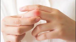 Trigger finger/finger pain causes and exercise #triggerfinger #fingerexercises #exercise