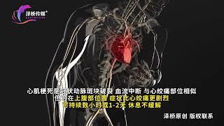 一条视频，教你如何识别心绞痛和心肌梗死 #3d #健康#3danatomy #人体 #科普 #心绞痛 #解剖学 #动画