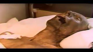 Acute radiation syndrome the Ministry of defense of the USSR 1988 HD