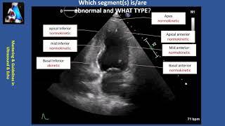 Wall Motion Abnormality Part II: cases & practice