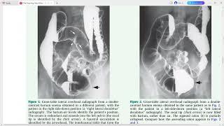 GIT IMAGING THE TEACHING FILES SERIES