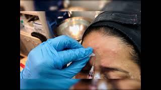 Botox for Skin Rejuvenation | Kiran's Clinic - Top Dermatology Clinic in Andheri, Mumbai