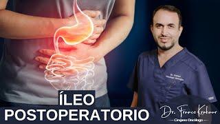 Íleo Postoperatorio/ Dr. Franco Krakaur/ Cirujano Oncólogo