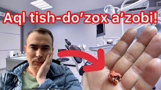 Aql tish “do'zox azobi” ekan