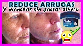 VASELINE to REMOVE WRINKLES ? ? Removes STAINS in 20 minutes -YOLIANA GAMBOA