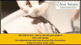 Removing The Scabs After The Hair Transplant Surgery - Dr.Olcay Saygin Zen Hair Transplant Clinic