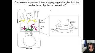 Aurox Conference on Microscopy Day 1 Session 3 SuperResolution