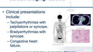 When, and When Not, to Use PET/CT Part 2