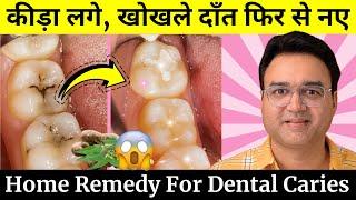 दांत में लगा कीड़ा, खोखला दांत फिर से नए जैसा | Remedy For Tooth Cavity | Dental Caries