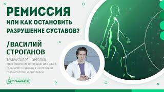 Ремиссия или как остановить разрушение суставов?  | Василий Строганов