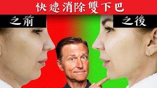 快速消除雙下巴運動,自然療法,柏格醫生 Dr Berg