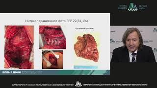 A multimodal approach in pleural mesothelioma treatment (Evgeny Levchenko )