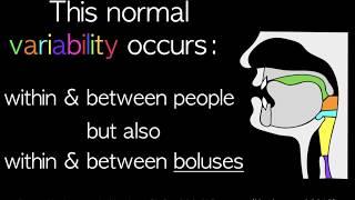 Bolus depth variability in a healthy adult swallowing ice, pudding, thin, thin honey, honey, nectar