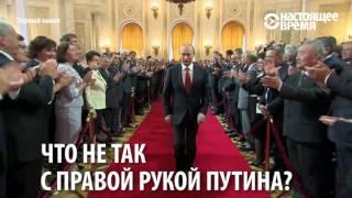 У Путина диагностировали "походку стрелка" / Посмотрите на его правую руку