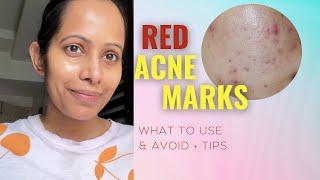 RED ACNE Marks on Face – what to use and AVOID | Best Products for different skin types