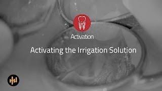 Helse Ultrasonic Endo - Activation - Activating the Irrigation Solution