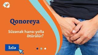 İrinli və ağrılı sidiyə çıxma - Qonoreya (Süzənək) xəstəliyi | Sadəcə et: Tibb