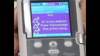 Air In line Alarms - CADD® Solis Ambulatory Infusion Pump