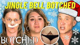 Jingle Bell Botched: Unbelievable Holiday Miracle Transformations | Botched | E!